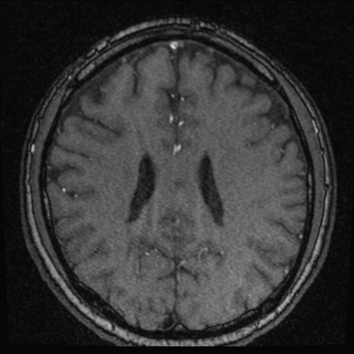 Click on the Serie image to view the images of VILLANUEVA, WILLIAM A.